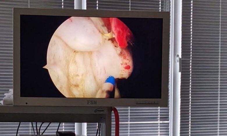 В Лидской ЦРБ появился прибор для операций без разрезов